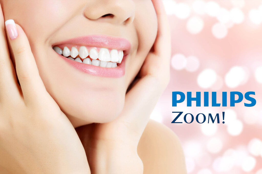 Teeth Whitening El Paso - Zoom! in-office whitening treatment